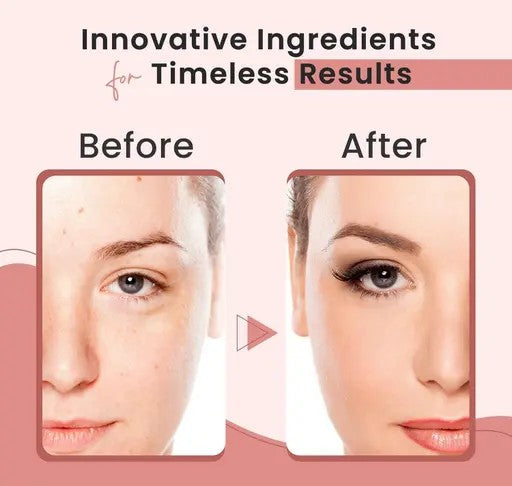 Bio-Collagen Overnight Face Mask – Korean Glass Skin Hydrogel Mask for Deep Hydration, Pigmentation Care, Anti-Aging & Pore Minimizing | Vitamin E & Centella