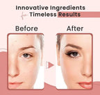 Bio-Collagen Overnight Face Mask – Korean Glass Skin Hydrogel Mask for Deep Hydration, Pigmentation Care, Anti-Aging & Pore Minimizing | Vitamin E & Centella